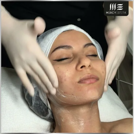 Mercy Estetik